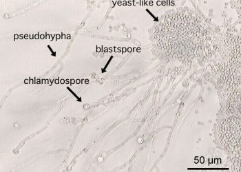 Yoga: A Healthy Way Of Improving General Wellbeing