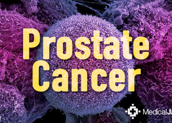 Yoga: A Healthy Way Of Improving General Wellbeing