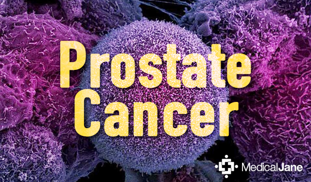 Yoga: A Healthy Way Of Improving General Wellbeing