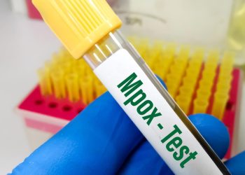 Ghana confirms 2 new Mpox cases, total now 4