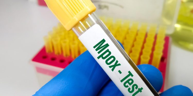 Ghana confirms 2 new Mpox cases, total now 4